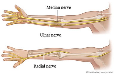 RADIAL TUNNEL SYNDROME